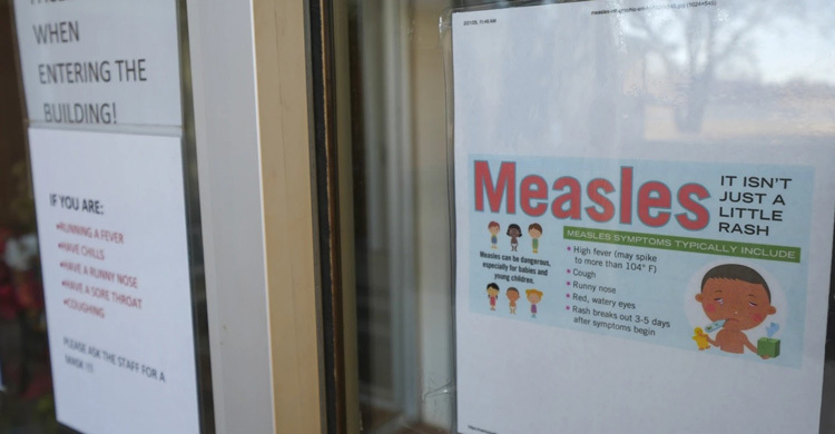 যুক্তরাষ্ট্রে ছড়িয়ে পড়েছে হাম, দুইজনের মৃত্যু